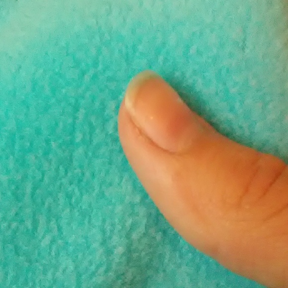 Blue jacket - Picture 2 of 4